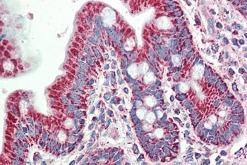 CADM1 Antibody