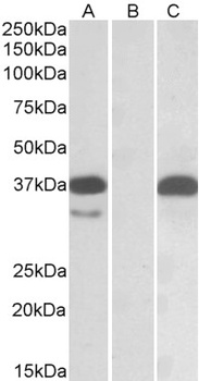 VLCAD Antibody