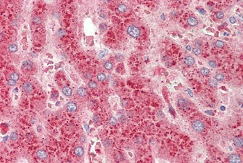 MK2 / MAPKAPK2 Antibody