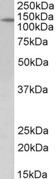 MK2 / MAPKAPK2 Antibody