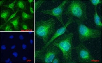 MK2 / MAPKAPK2 Antibody