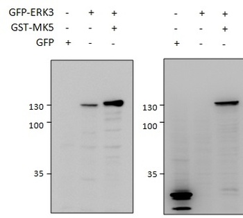 MK5 / MAPKAPK5 Antibody