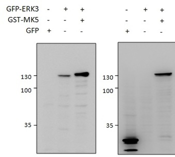 MK5/MAPKAPK5 Antibody