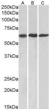 PTCH1 Antibody