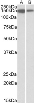 PTCH1 Antibody