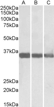 Crot Antibody