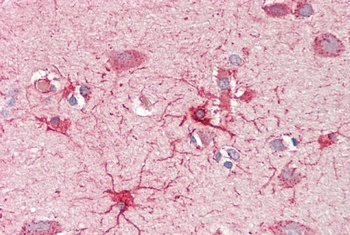 Pycard Antibody