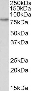 IFNGR1 Antibody