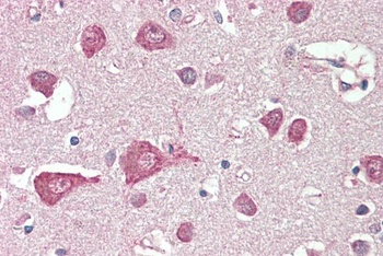 TNNT3 Antibody