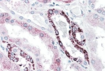 TNNI2 Antibody