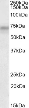 TNNI2 Antibody