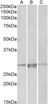 ZNRF1 Antibody