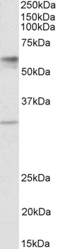 ZNRF1 Antibody