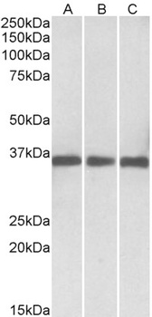 PNP Antibody