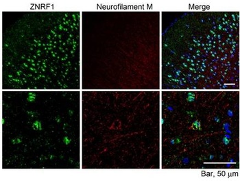 FABP4 Antibody