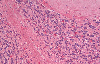 polo-like kinase 5 Antibody