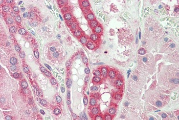 MDH1/MOR2 Antibody