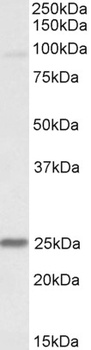 TNNI3 Antibody