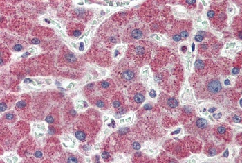 IRAK4 Antibody