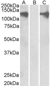 IRAK4 Antibody