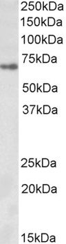 IGFBP1 Antibody
