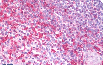 ADRA1B Antibody