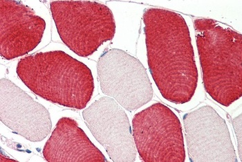 ADRA1B Antibody