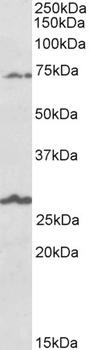 EAAT1/GLAST1 Antibody