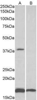 HOXD12 Antibody