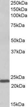THNSL2 Antibody