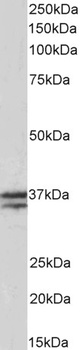 THNSL2 Antibody