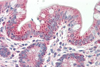 MIA / CD-RAP Antibody