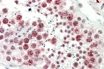 EEF1A2 Antibody