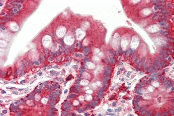 myotilin Antibody