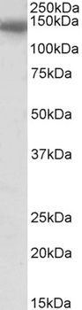 BBS7 Antibody