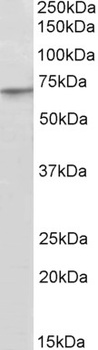 RPL23 Antibody