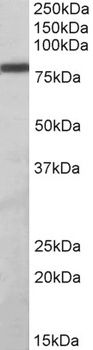 RPL23 Antibody