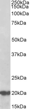 PCOLCE Antibody