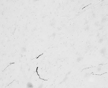 cardiac troponin T Antibody