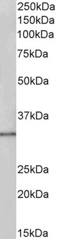 TSPAN14 Antibody