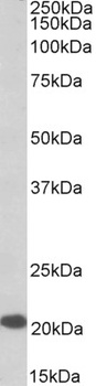 ENC1 Antibody