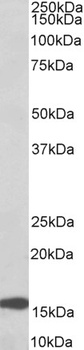 cytokeratin 20 Antibody