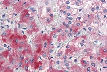 cytokeratin 20 Antibody