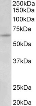 SLC26A6 Antibody
