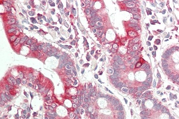 ICAM1 Antibody