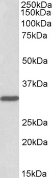 Uromodulin Antibody