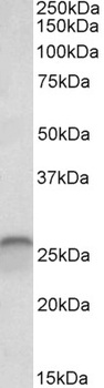 MCTS1 Antibody