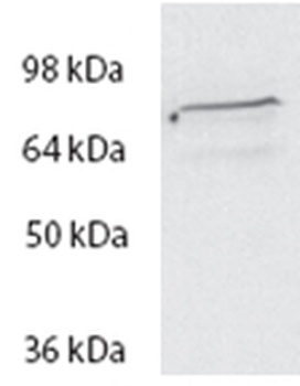 ROR1 Antibody