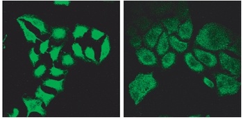 ROR1 Antibody