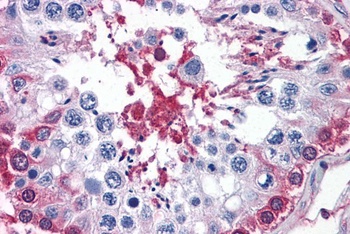 GPI / Neuroleukin Antibody
